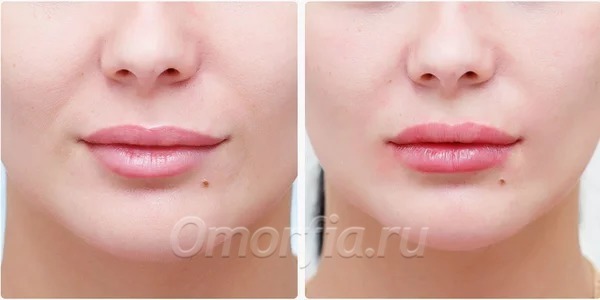 Фото из сети Интернет