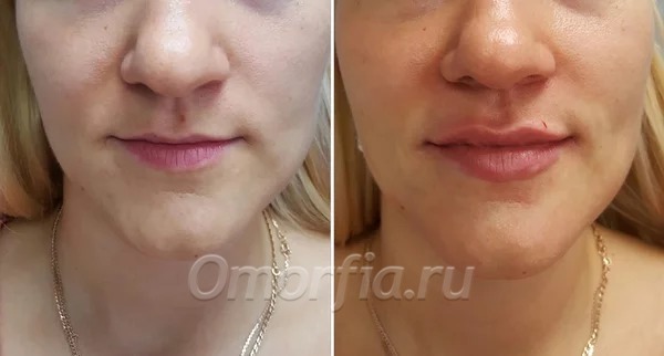 Фото из сети Интернет