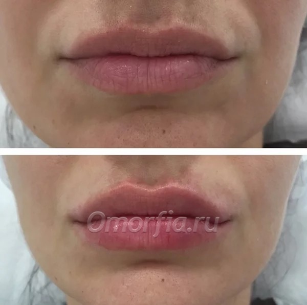 Фото из сети Интернет