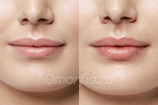 Фото из сети Интернет