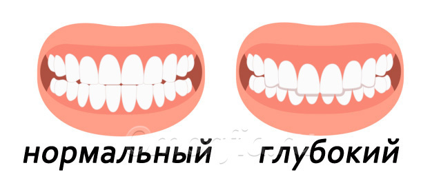 Для сравнения