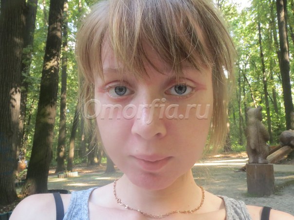 Image title