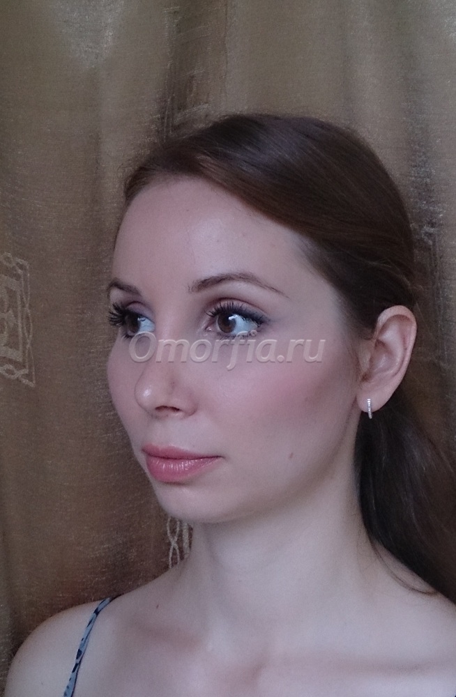 Image title